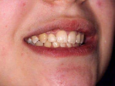 beautiful teeth