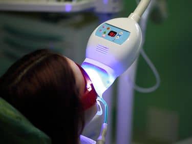 DURING TREATMENT - Using the Zoom / Beyond / Advanced Whitening type UV lamp to activate the whitening gel